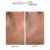 Mesoten Exopeptide before after results