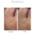 Revacoll before after results