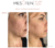 Mesoten Pure skin face before after results